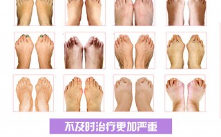 足球鞋顶脚趾正常吗，足球鞋顶脚趾还能穿吗